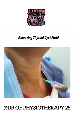 Removing Thyroid Cyst Fluid Safely | Medical Procedure Explained 🥼 #medicalshorts