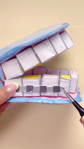 치아교정 DIY 만들기와 놀이 아이디어