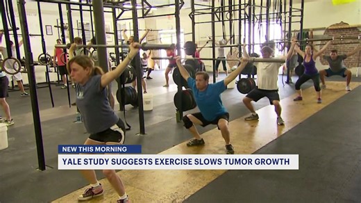 Yale School of Medicine uncovers breakthrough in cancer research