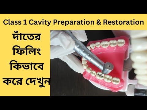 Class 1 Cavity Preparation & Filling | দাঁতের ফিলিং কিভাবে করে দেখুন Step by Step | Dental Tutorial