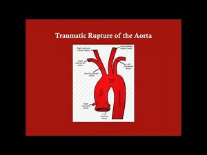 Chest Trauma (Part 2) - CRASH! Medical Review Series