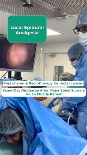 Awake Spine Surgery Success : Under Local Epidural Analgesia | Dr. Abhinandan | #awakespinesurgery