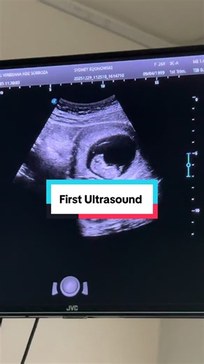 First Ultrasound Experience at 10 Weeks Pregnancy