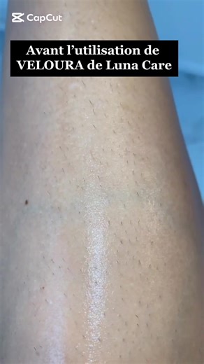 #maroc #santefemme #epilation #propre #LunaCare