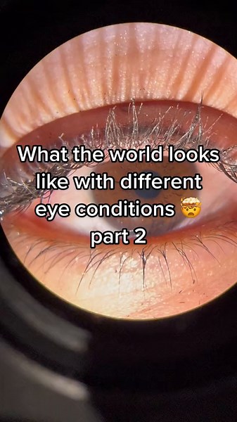 Understanding Different Eye Conditions Through Line of Sight Vision