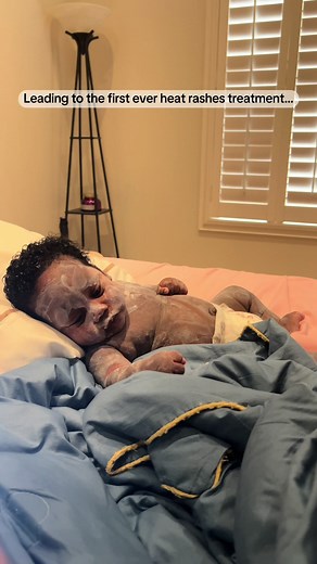 It started off as a simple heat rash. We thought it would fade… But it turned into a long journey of tears, prayers, and tiny wins. #EczemaBaby #MomLifeUnfiltered #BabySkinJourney #Baby #BabyEczema #RealMomMoments #HealingInProgress #ThatSmileTho #ViralMoments #TikTokBaby #SensitiveSkinCare #BabyEczemaAwareness #fyp #fypシ #fypシ゚viral