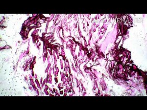 Real slide of loose areolar connective tissue in 4x,10x and 40x