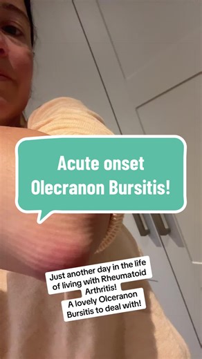 Understanding Olecranon Bursitis and RA Impacts