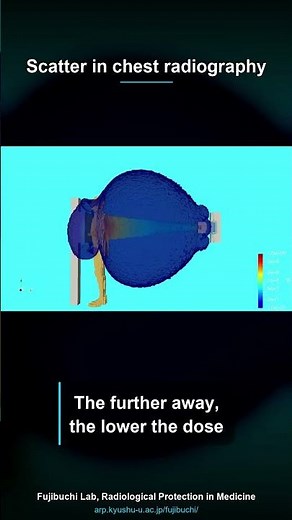 How far does scatter travel in chest radiography? #shorts