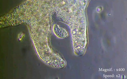显微镜下的变形虫（Amoeba proteus）