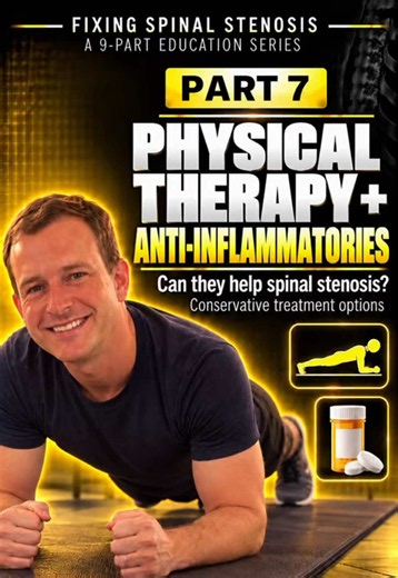 Part 7 of 9: Can Physical Therapy Anti-Inflammatories Help Spinal Stenosis? For many patients with #SpinalStenosis, surgery is not the first step. Structured #PhysicalTherapy can improve pain, walking ability, physical function, and daily activity. In one randomized trial, patients receiving supervised PT were also less likely to undergo surgery within 1 year than those doing unsupervised home exercise: 7.0% vs 23.3%. Anti-inflammatories such as NSAIDs may also help control pain, particularly in
