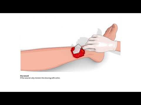 How to use PROMOGRAN and PROMOGRAN PRISMA