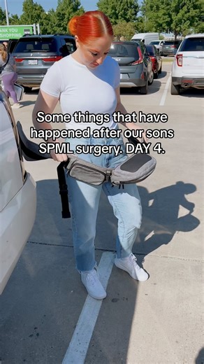 Some things that have happened after our son’s SPML surgery. DAY 4. 1. Significant bruising but it’s normal and will heal. 2. I can tell when he’s sore. They have prescribed him Valium and Tylenol as needed. 3. Knowing this was a surgery that would bring relief and not complete healing of tension and tone, it has definitely done just that! 4. His legs are now able to open comfortably (not all the way because he still has hip dysplasia) but a significant difference of calmness with his body. 5. T