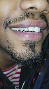 Too Much Sauce ❄❄❄❄ VS Diamond Flooded!! ... Come See Me I'll Get You Right! RIGHT SHYNE GRILLZ 4058757030 | Right Shyne Grillz | Facebook