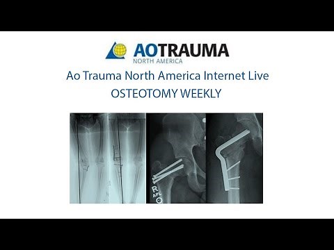 Week 5-M Graves Complex Femur Deformity:Clamshell Osteotomy