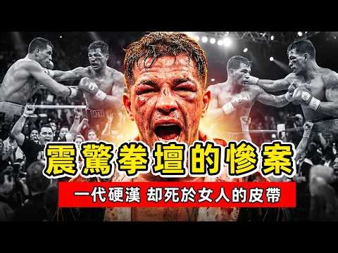 拳壇最硬的男人，為何死於一根名牌包皮帶？揭秘「雷電」加蒂的血色傳奇與離奇命案！阿圖羅·加蒂｜Arturo Gatti
