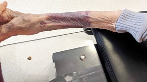 Maltraitance en CHSLD: la fille d’une victime remporte son combat aux petites créances