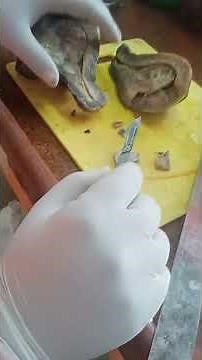 Grossing of uterus cervix &ovary