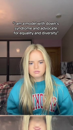 Embracing Diversity: Models with Disabilities Shine