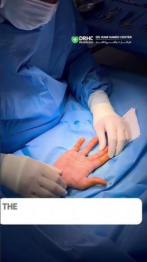 Finger Numbness & Wrist Pain? | Dr. Rami Hamed Explains Carpal Tunnel Syndrome