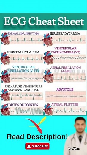 10 Heart Rhythms You Need to Know NOW!