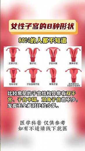 你嘅子宮係咩形狀？｜8種子宮形態，8成女性原來唔知 #深圳怡康醫院 #科普