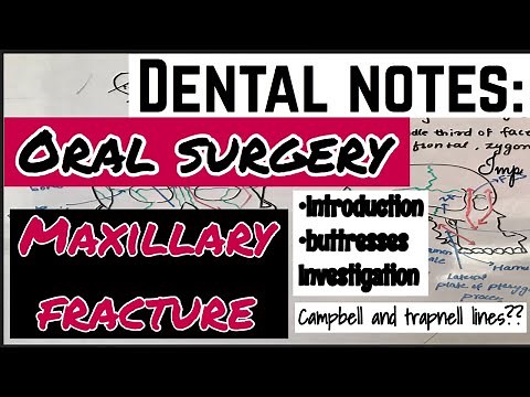 MAXILLARY FRACTURE || ORAL SURGERY || DENTISTRY LECTURE || imp