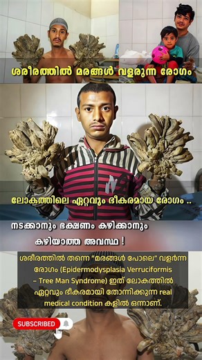 ശരീരത്തിൽ മരങ്ങൾ വളരുന്ന #shorts #fyp