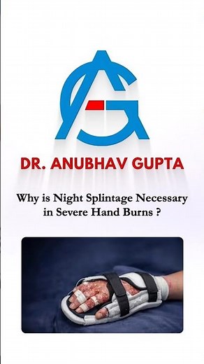 Why Is Night Splinting Necessary in Severe Hand Burns?