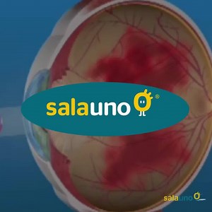 😯 La diabetes daña las venas y arterias del ojo, causando sangrados y, con el tiempo, ceguera. Y puesto que no hay síntomas en las primeras etapas, la mayoría de la gente se descuida. Has click en REGISTRARTE 👇 Tel.- (55) 4163 7477 | Salauno Tu doctor de los ojos
