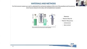 Finite Element Analysis of a 3D Printed Radial Head Prosthesis for Verifying Mechanical Resistance in Case of Bone-Resorption
