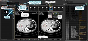 Easy DICOMソフトウェア (低価格で気の利いたソフトウェアです）
