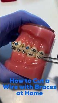 How to Cut an Orthodontic Wire at Home - David Ross Orthodontics