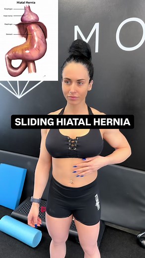 Hiatal hernia content online is full of “push it down” hacks. Here’s the issue: a sliding hiatal hernia lives inside the rib cage. You can’t safely grab it from the surface. What you can train is the system around it: diaphragm mechanics, rib cage position, and pressure management. At the esophagogastric junction there isn’t one valve. It’s a stacked barrier: the LES (smooth muscle) the crural diaphragm (skeletal muscle) connective tissue that helps keep the junction aligned When posture collaps