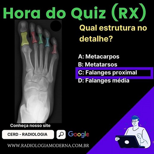 Radiografia do pé: Falanges proximal