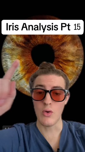 Russell on Instagram: "Comment “detox” and I’ll send you the link to my 1:1 full health assessment and regeneration consultations. #naturalhealing #holistichealth #detox #healing #iridology"