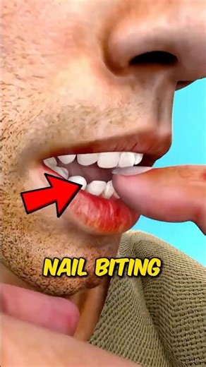 Nail Biting Is Worse Than You Think… Here’s Why