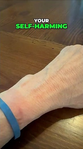 Stop Self-Harm: Effective Techniques #shorts