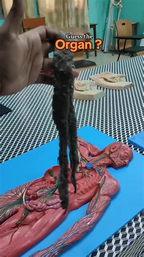 Guess the Organ: A Fun Medical Challenge