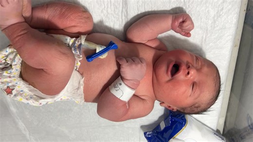 3.6K views · 67 reactions | Formula Feeding in Newborn Baby for Observation | Safe NICU Feeding Guide #viral #cute #newborn #shorts #shortvideo | Anoop Gautam | Facebook