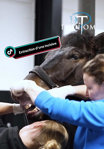 Extraction d’une incisive Ce cheval nous a été référé en raison de signes répétés de résistance lors du travail monté. À l’examen externe, peu d’éléments étaient visibles. Aucun gonflement évident, aucune anomalie marquée. En revanche, un examen buccal approfondi a révélé un détail subtil : un minuscule trou dans l’une des incisives, à peine plus grand que la pointe d’une aiguille. Des examens complémentaires, incluant des radiographies, ont alors été réalisés. Sous la surface, une large cavité