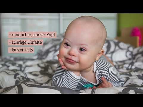 Trisomie 21 – Down-Syndrom einfach erklärt | sofatutor