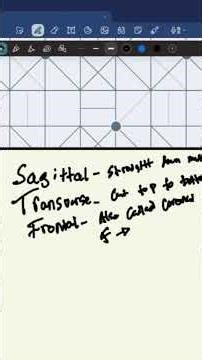 Anatomical body planes. #nursingstudent #nursing #nursingstudents #nursingeducation