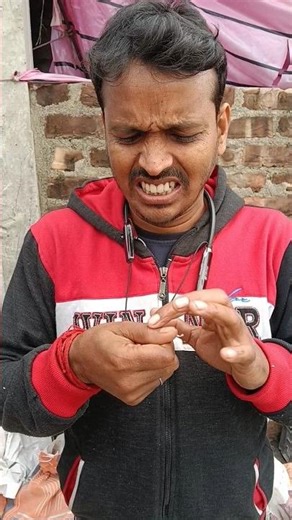 Something Got Stuck in His Hand 😣 He Kept Trying to Remove It Again and Again!