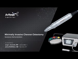 Minimally Invasive Chevron Osteotomy
