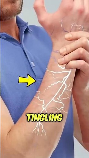 Your Arm Isn’t “Asleep”… This Is What’s Really Happening #viral