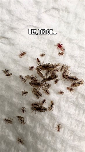 Lice Lessons Oil Solution is the safest, most effective at home head lice treatment option there is! #lice #licetreatment #licetok #pesticidefree