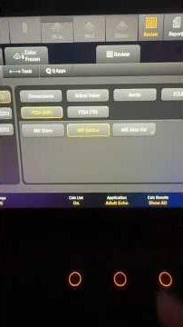 Next up: vena contracta. Hope this helps. #sonographer #ultrasoundtech #ultrasoundstudent #health