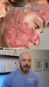 Dermatologist reacts to drastic acne transformation! #acnetransformation #dermreacts | BMarshall Carter