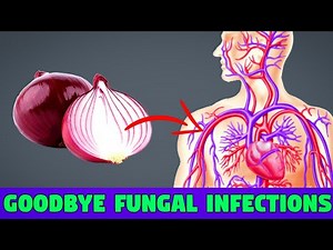 Top 10 Anti Fungal Superfoods To Eat Every Day